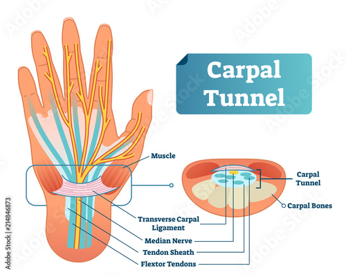 Carpal tunnel vector illustration scheme. Medical labeled diagram closeup with muscle, transverse carpal ligament, median nerve, tendon sheath, flextor tendons and bones. photo