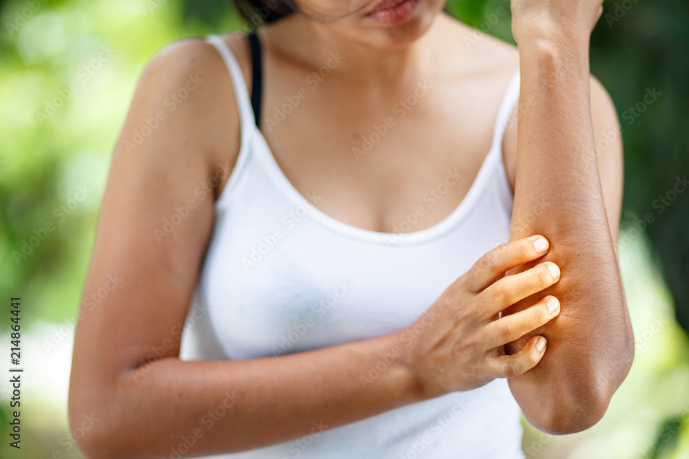 Young women hand scratch the itch on the arm, healthcare and medicine concept. Young women hand scratch the itch on the arm, healthcare and medicine concept.