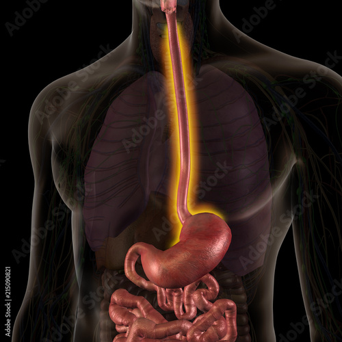 Male Internal Anatomy with Esophagitis Condition Highlighted