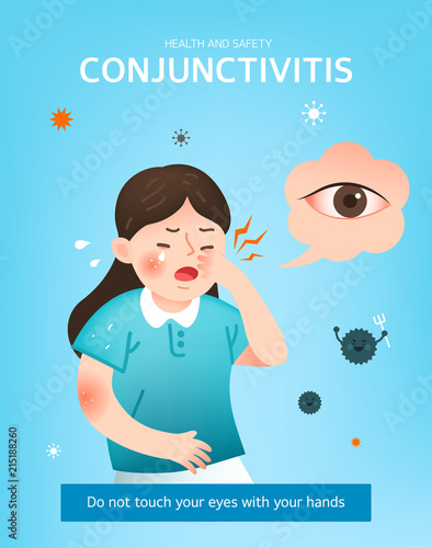 How to prevent  for conjunctivitis