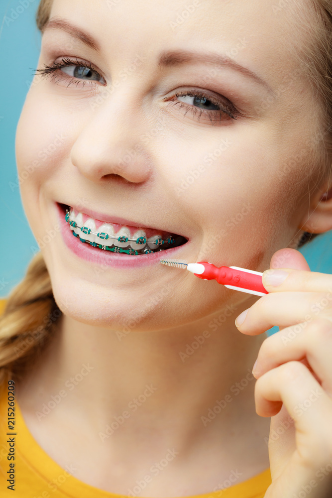 Woman with teeth braces using interdental brush Woman with teeth braces using interdental brush
