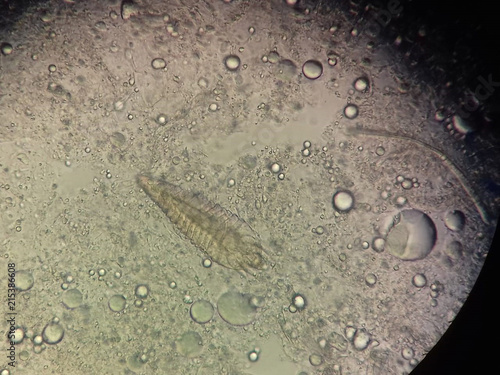 Demodex parasite under skin in dog or people take photo from microscope photo