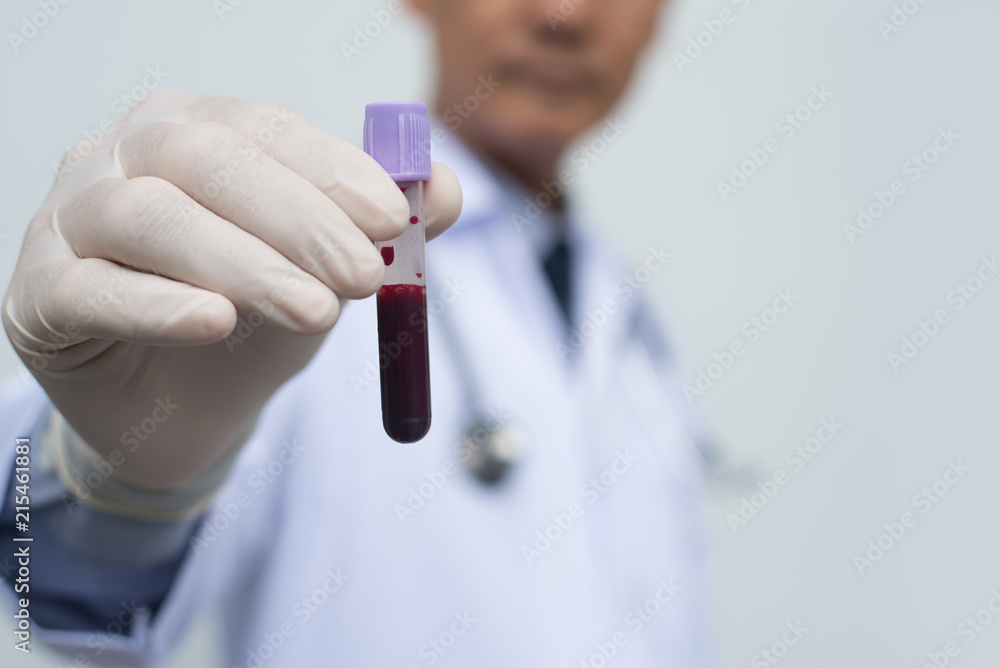Male doctor showing whole blood in test tube Male doctor showing whole blood in test tube