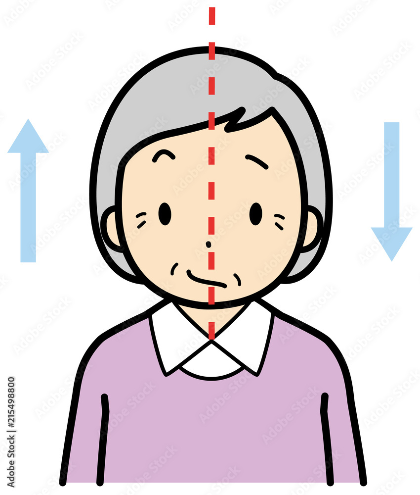 脳梗塞チェック Stock イラスト Adobe Stock