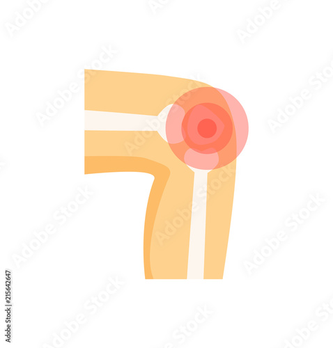 Knee Pain Abstract Visualization of Harmed Joint