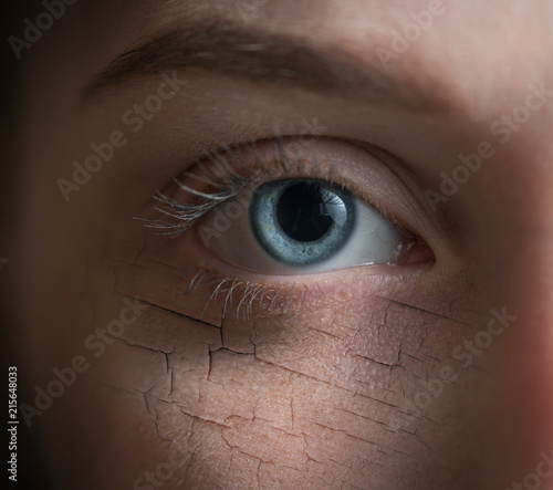 Woman with cracked on face as cosmetic and dehydration effect concept.