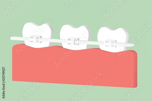 orthodontic teeth or dental braces - tooth cartoon 3d render