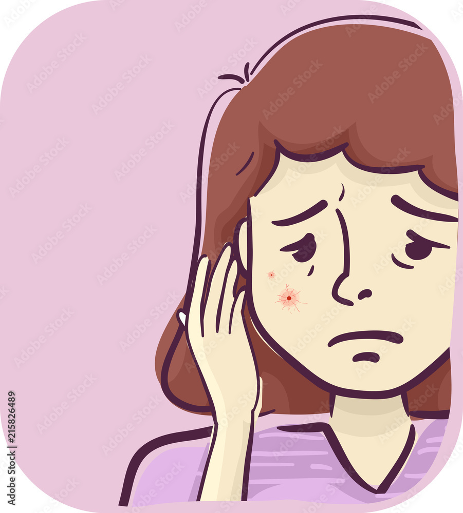 Girl Symptoms Red Spot Vein Mole Face Illustration Girl Symptoms Red Spot Vein Mole Face Illustration