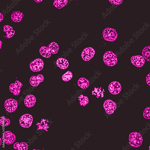 Human acute leukemia cell line nuclei