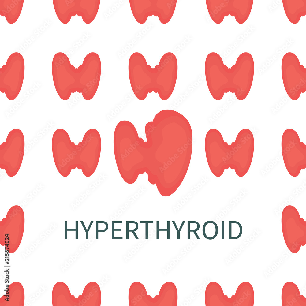 Hyperthyroid medical poster. Pattern of healthy thyroid glands with one overactive organ affected by the illness. Front view anatomy sign. Human endocrine system. Medical symbol. Vector illustration. Hyperthyroid medical poster. Pattern of healthy thyroid glands with one overactive organ affected by the illness. Front view anatomy sign. Human endocrine system. Medical symbol. Vector illustration.