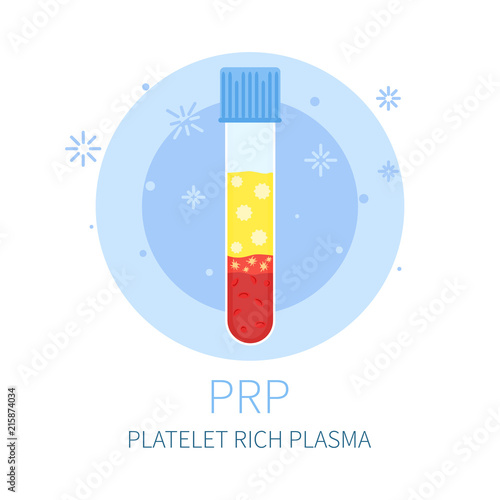 Test tubing flask filled with blood for PRP procedure on blue background. Platelet rich plasma laboratory equipment. Medical concept. Vector illustration.