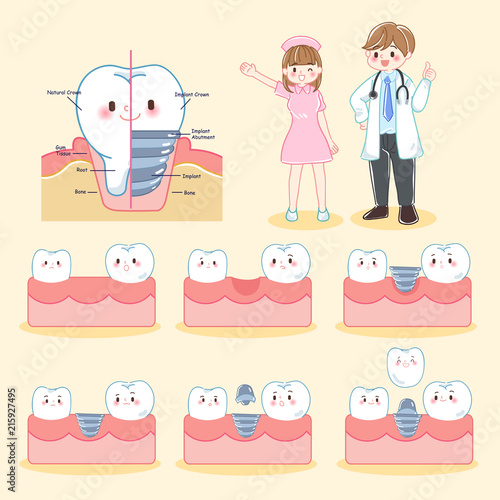 dentist with tooth and implant