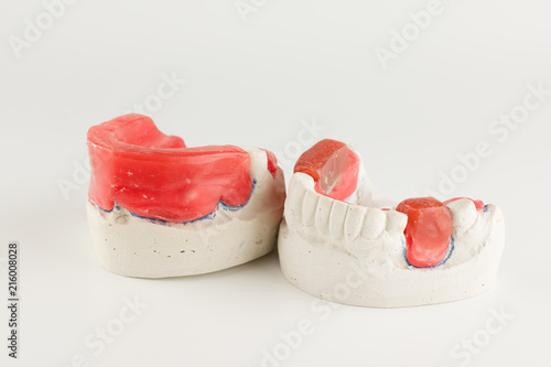 wax rollers on the tooth model