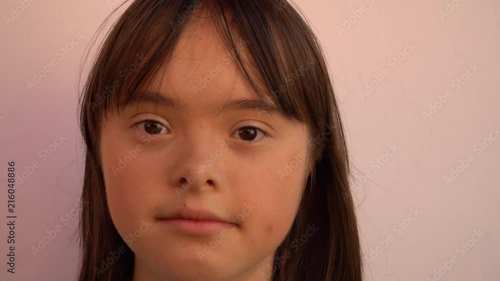 Down syndrome girl smiling Down syndrome girl smiling