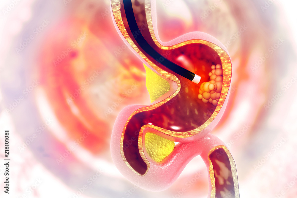 Endoscopy Stock Illustration Adobe Stock