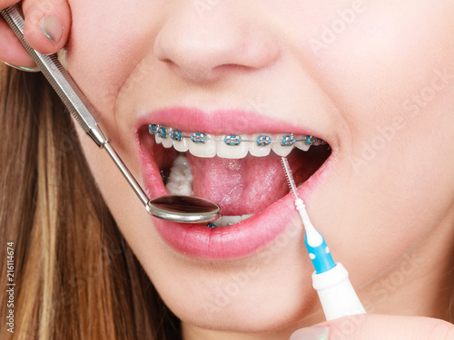 Woman with braces having dentist appointment photo