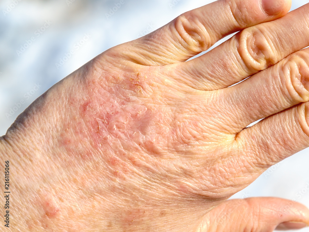 Fototapeta premium Detailed closeup of dry mature woman hand