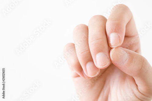 Hand on the white background. Dry, damage nails. Woman's issues. Problem and solution. Empty place for text.