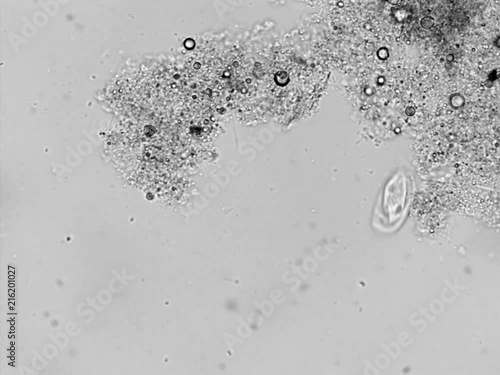 Photomicroscopy of activated sludge from the bacterial wastewater treatment zone photo