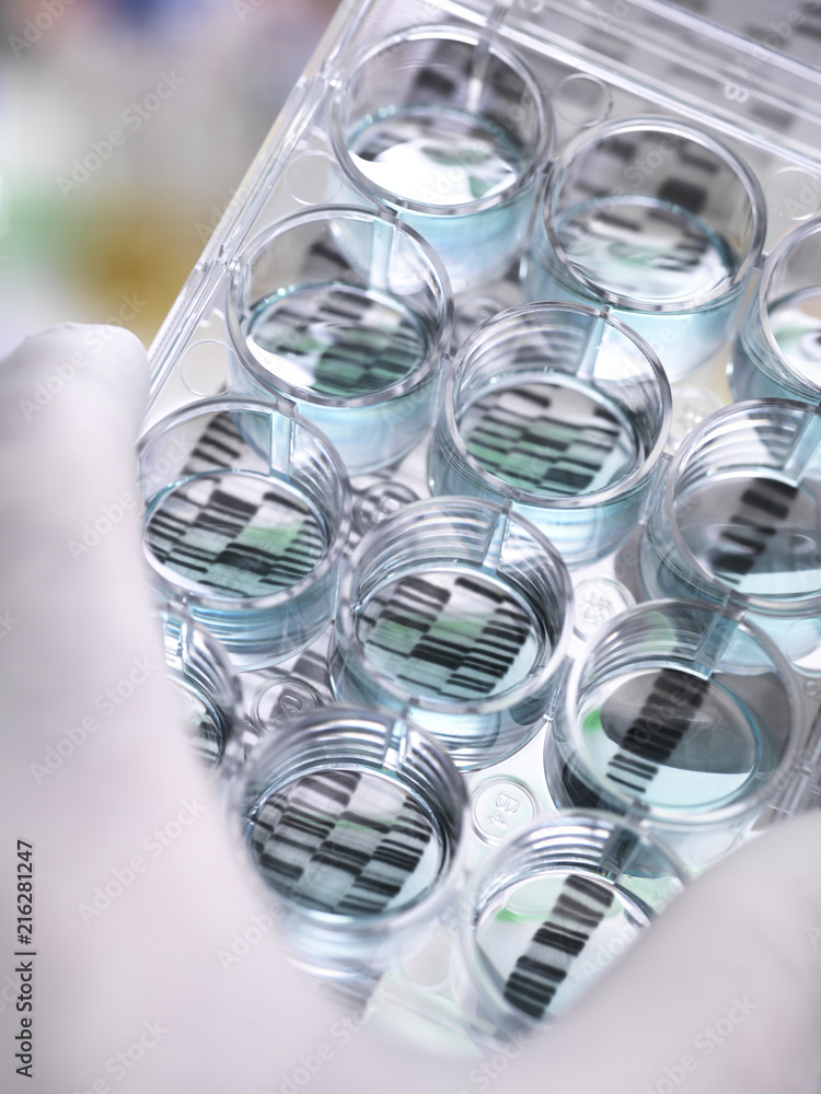 Genetic Research, Scientist holding a multi well plate and DNA gel ...