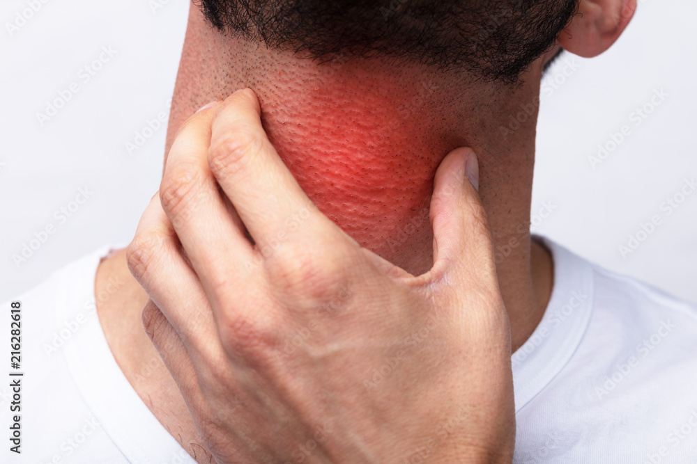 Obraz premium Man Suffering From Sore Throat