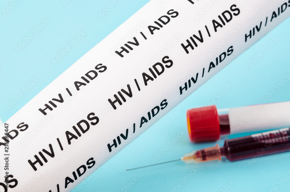 Obraz premium HIV test concept.