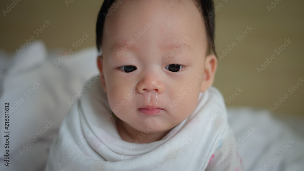 The Asian boy have a cold with having snot. The Asian boy have a cold with having snot.