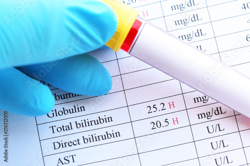 Abnormal high bilirubin test result with blood sample tube photo