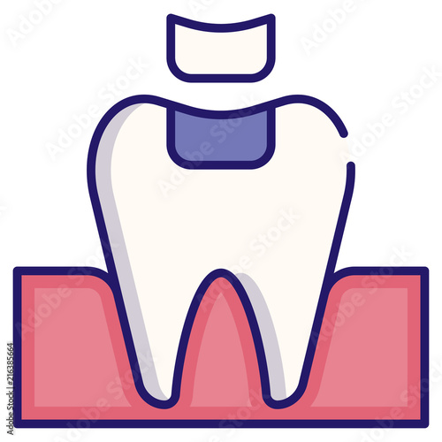 Dental fillings LineColor