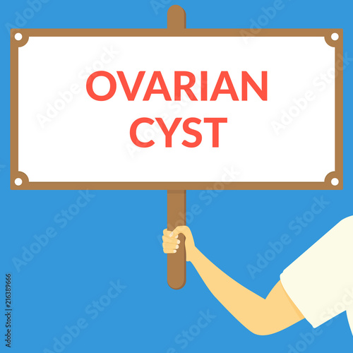OVARIAN CYST. Hand holding wooden sign photo