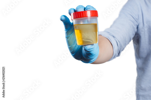 Hand in a blue glove holding medical urine test, isolated on white background