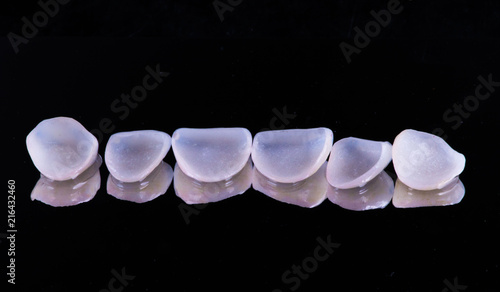 dental crowns and veneers