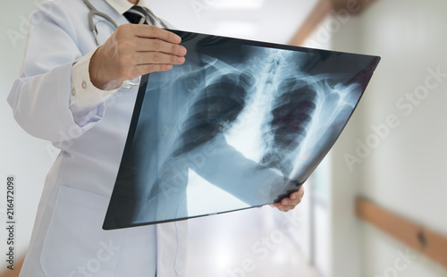 Doctor examining lung x-ray film photo