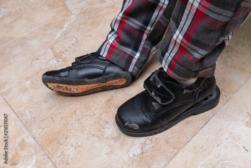 kid wearing a pair of badly broken leather shoes