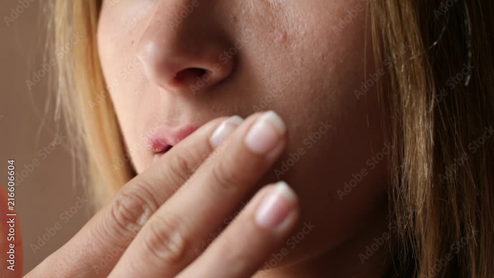 Woman touches the sores from herpes on her lips. Women's lip ulcers herpes closeup. Beautiful lips were covered with cold sores. The girl licks her lips covered with herpes. Woman touches the sores from herpes on her lips. Women's lip ulcers herpes closeup. Beautiful lips were covered with cold sores. The girl licks her lips covered with herpes.