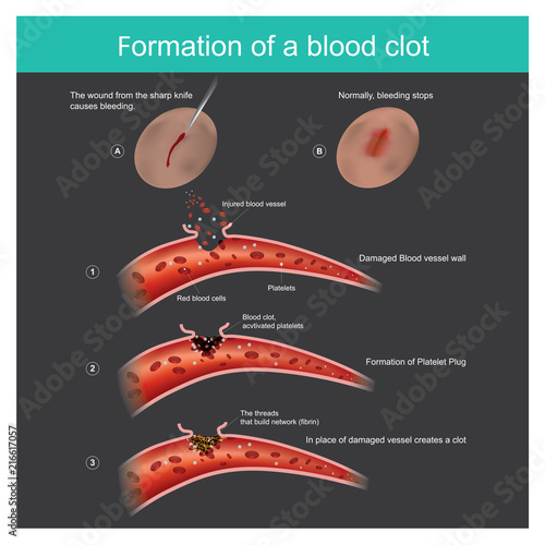 Formation of a blood clot. The wound from the sharp knife on skin Slightly bleeding, The body can respond to stop blood out flow from the capillaries, And anti-bacterial through the body.