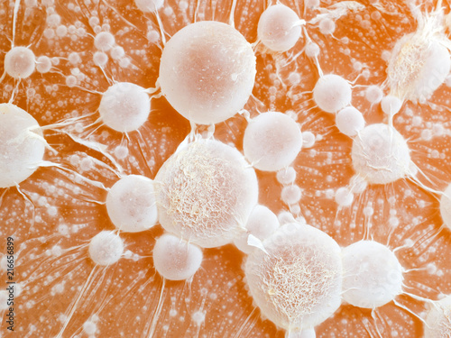 Fotografia cancer tumour