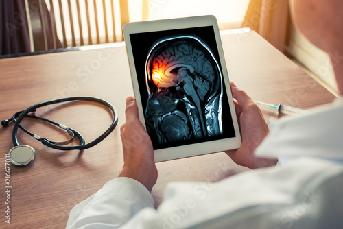 Doctor holding a digital tablet with x-ray of brain and skull skeleton. Headache, meningitis and migraine concept photo