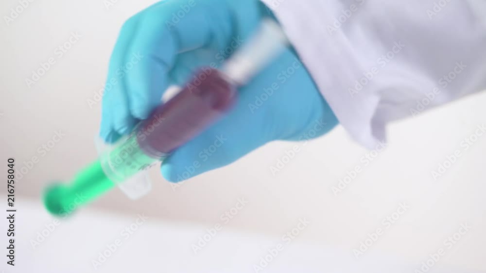 A doctor with glove on on hands picks up a syringe full of blood and rotates it in his hands and then sets it back down A doctor with glove on on hands picks up a syringe full of blood and rotates it in his hands and then sets it back down