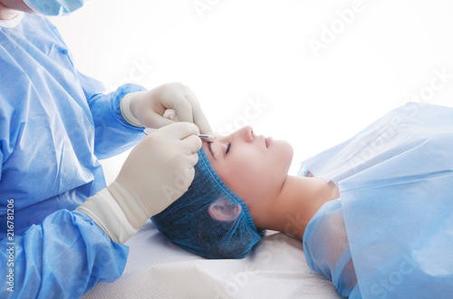 Φωτογραφία Upper eyelid blepharoplasty