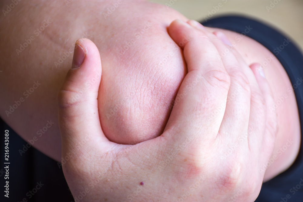 Person or patient keeps to elbow with palm of the other hand due to severe pain in the elbow joint, trauma or injury, fracture, rupture or sprain, as symptom of chronic joint disease recurrence Person or patient keeps to elbow with palm of the other hand due to severe pain in the elbow joint, trauma or injury, fracture, rupture or sprain, as symptom of chronic joint disease recurrence