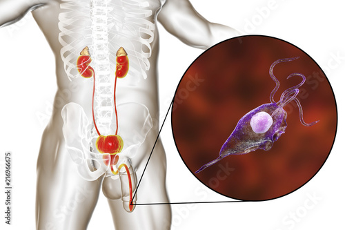 Trichomoniasis infection in man, 3D illustration showing male anatomy genitourinary system and close-up view of Trichomonas vaginalis protozoan causing urethritis photo