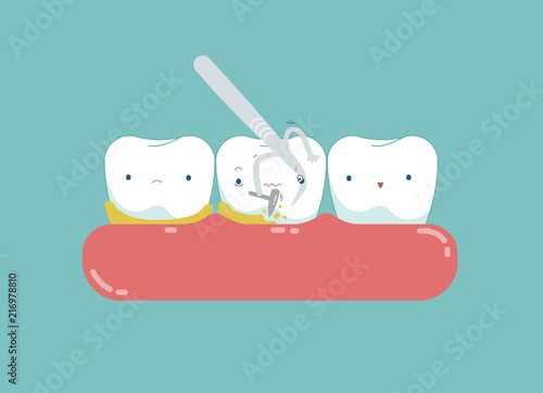 Equipment of dental is cleaning tooth for good healthy.