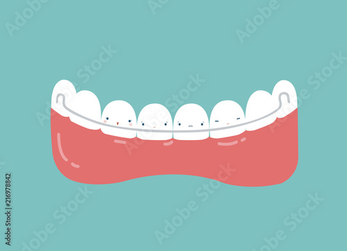 Retainer teeth, dental concept.