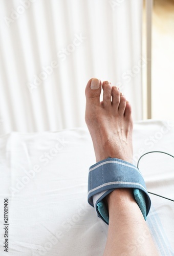 ankle sprain and electrotherapy