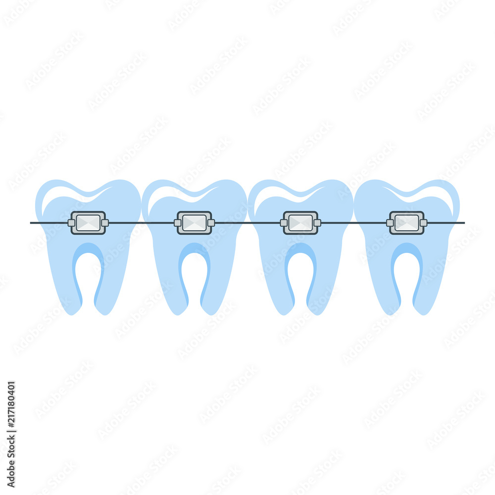 Healthy well-groomed teeth in braces. Dentistry and oral care. Flat vector cartoon illustration. Objects isolated on white background. Healthy well-groomed teeth in braces. Dentistry and oral care. Flat vector cartoon illustration. Objects isolated on white background.