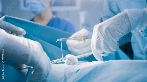 Close-up on Professional Surgeon Suture Wound after Successful Surgery. In the Background Modern Hospital Operation Room.
