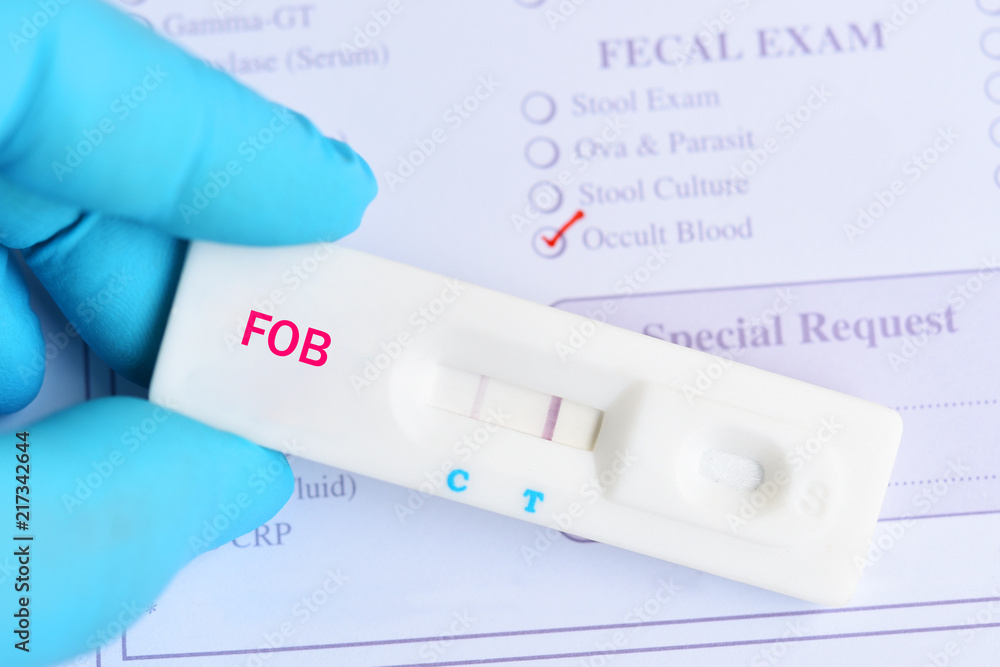Fecal occult blood test (FOBT) positive by using rapid test cassette