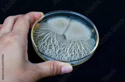 Beautiful bacterial colonies of Bacillus sp growing on agar plate photo