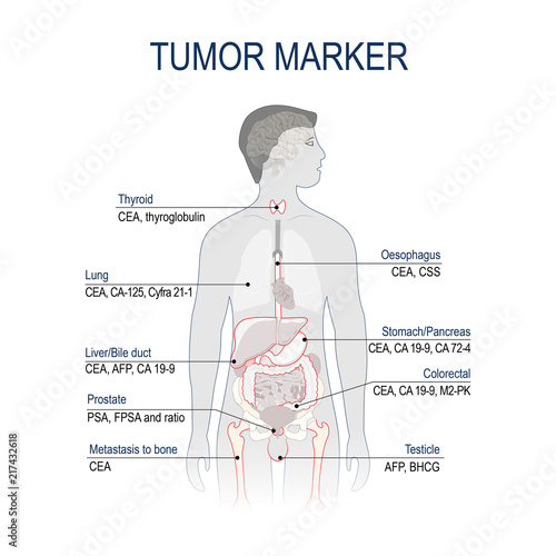 Tumor marker or biomarker.